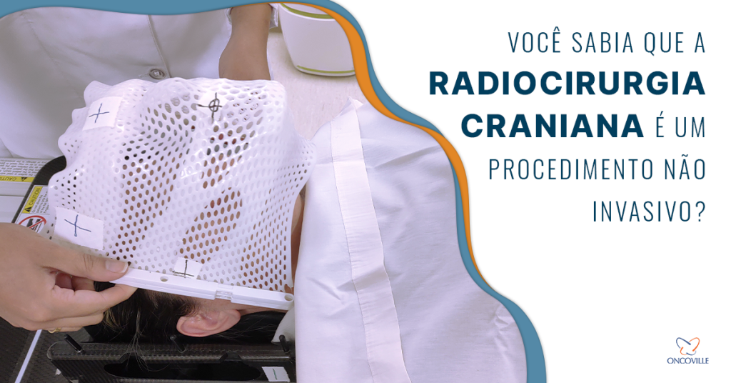 Radiocirurgia craniana é um procedimento não invasivo usado para tratar tumores no cérebro ou no sistema nervoso central