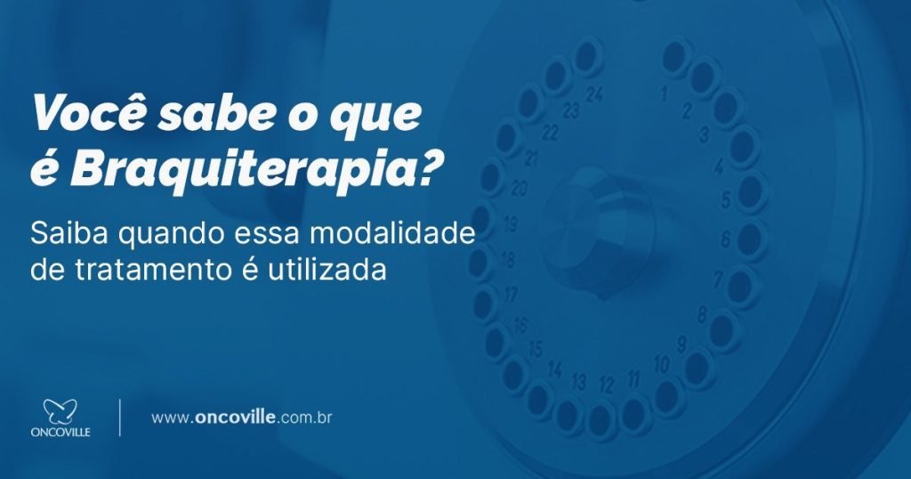 Tudo o que você precisa saber sobre o tratamento com braquiterapia