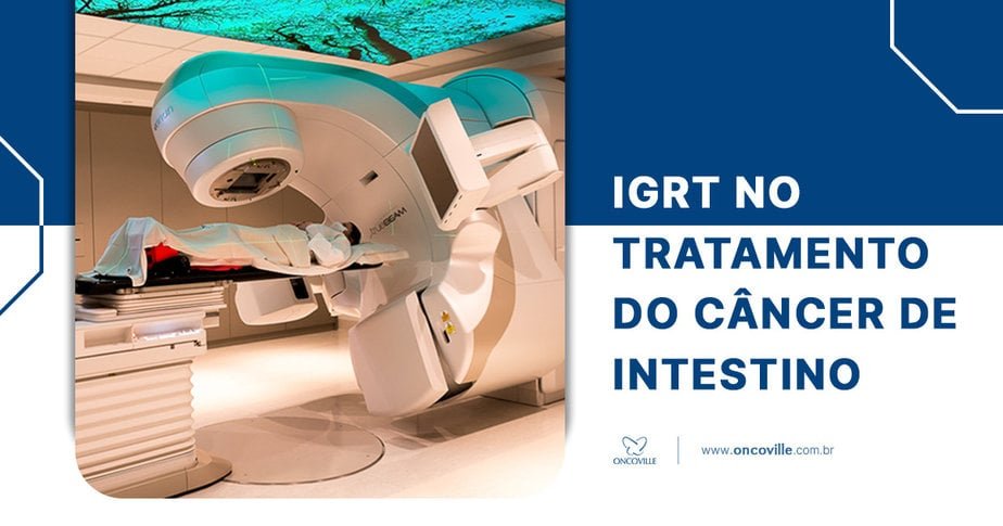 IGRT no tratamento do Câncer de Intestino