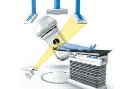 IGRT – Radioterapia Guiada por Imagem