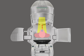 Radioterapia Superficial com Elétrons (Eletronterapia)