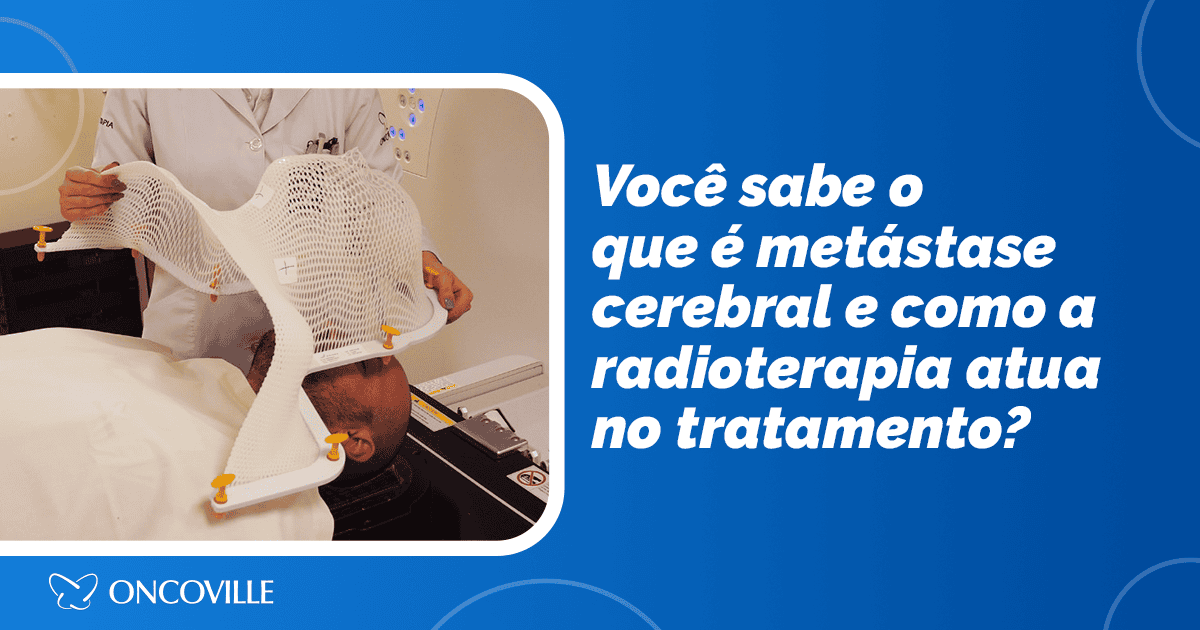 Radioterapia é ferramenta fundamental para o tratamento da metástase cerebral