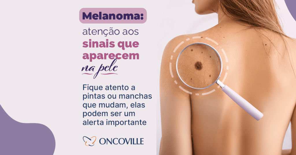 Melanoma: atenção aos sinais que aparecem na pele